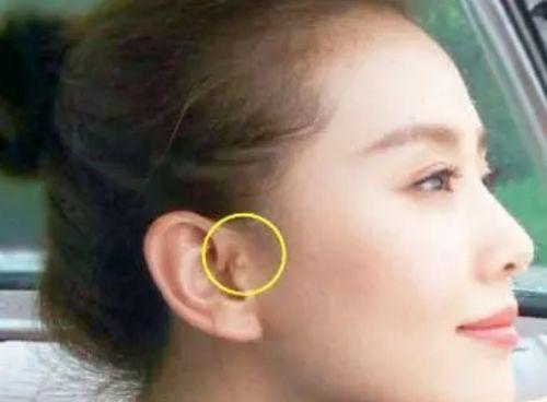 宝宝吃土耳瓜,探索土耳其瓜的营养魅力